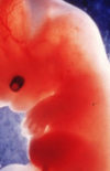 (Français) L'embryon humain est-il une personne ?